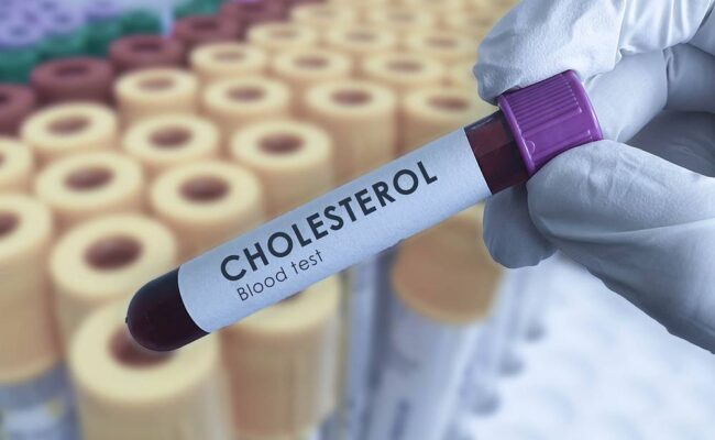 Badanie cholesterolu: próbka krwi do lipidogramu